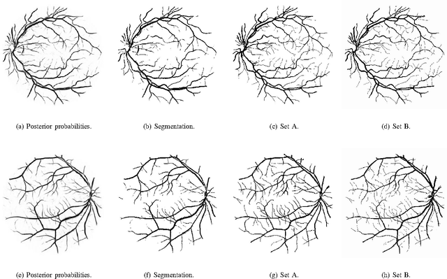 Figure 4 for Retinal Vessel Segmentation Using the 2-D Morlet Wavelet and Supervised Classification