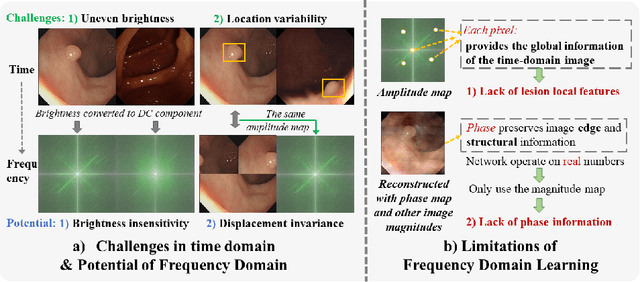 Figure 1 for FFCNet: Fourier Transform-Based Frequency Learning and Complex Convolutional Network for Colon Disease Classification
