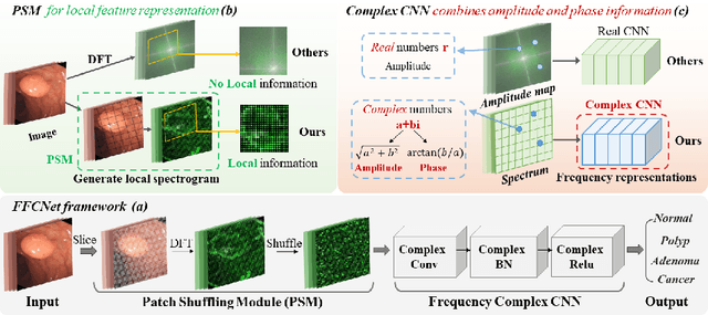 Figure 3 for FFCNet: Fourier Transform-Based Frequency Learning and Complex Convolutional Network for Colon Disease Classification