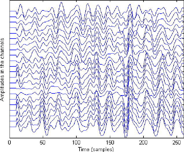 Figure 2 for Multivariate Temporal Dictionary Learning for EEG