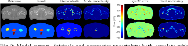 Figure 3 for Uncertainty in multitask learning: joint representations for probabilistic MR-only radiotherapy planning