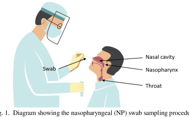 Figure 1 for Design of a Low-cost Miniature Robot to Assist the COVID-19 Nasopharyngeal Swab Sampling