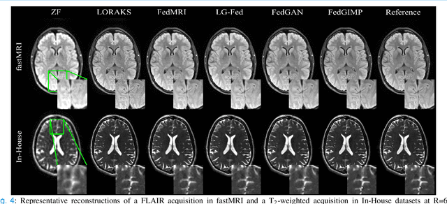 Figure 4 for Federated Learning of Generative Image Priors for MRI Reconstruction