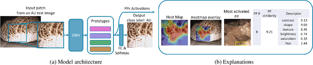 Figure 1 for Interpretable Deep Learning Classifier by Detection of Prototypical Parts on Kidney Stones Images