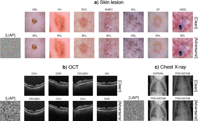 Figure 1 for Simple black-box universal adversarial attacks on medical image classification based on deep neural networks