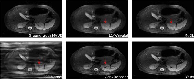 Figure 2 for Robust Compressed Sensing MRI with Deep Generative Priors