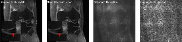 Figure 3 for Robust Compressed Sensing MRI with Deep Generative Priors