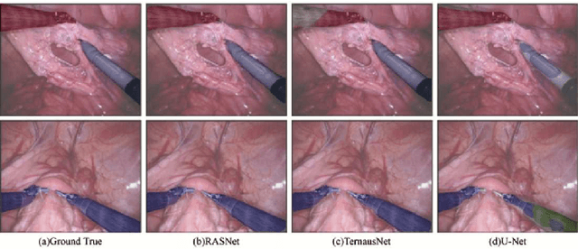 Figure 3 for RASNet: Segmentation for Tracking Surgical Instruments in Surgical Videos Using Refined Attention Segmentation Network