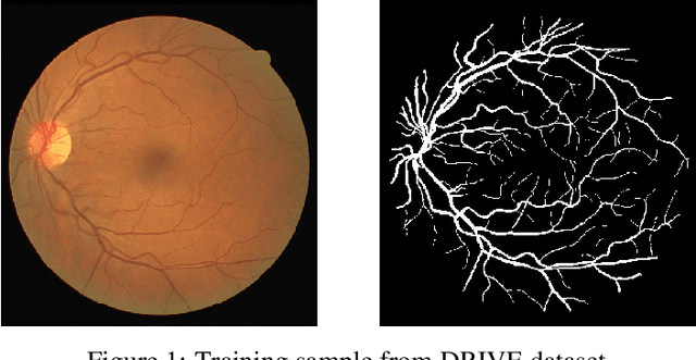 Figure 1 for Exploring The Limits Of Data Augmentation For Retinal Vessel Segmentation