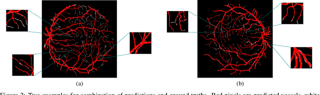 Figure 3 for Exploring The Limits Of Data Augmentation For Retinal Vessel Segmentation