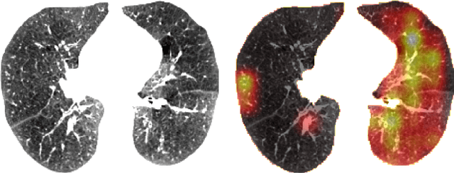 Figure 4 for Context Matters: Graph-based Self-supervised Representation Learning for Medical Images