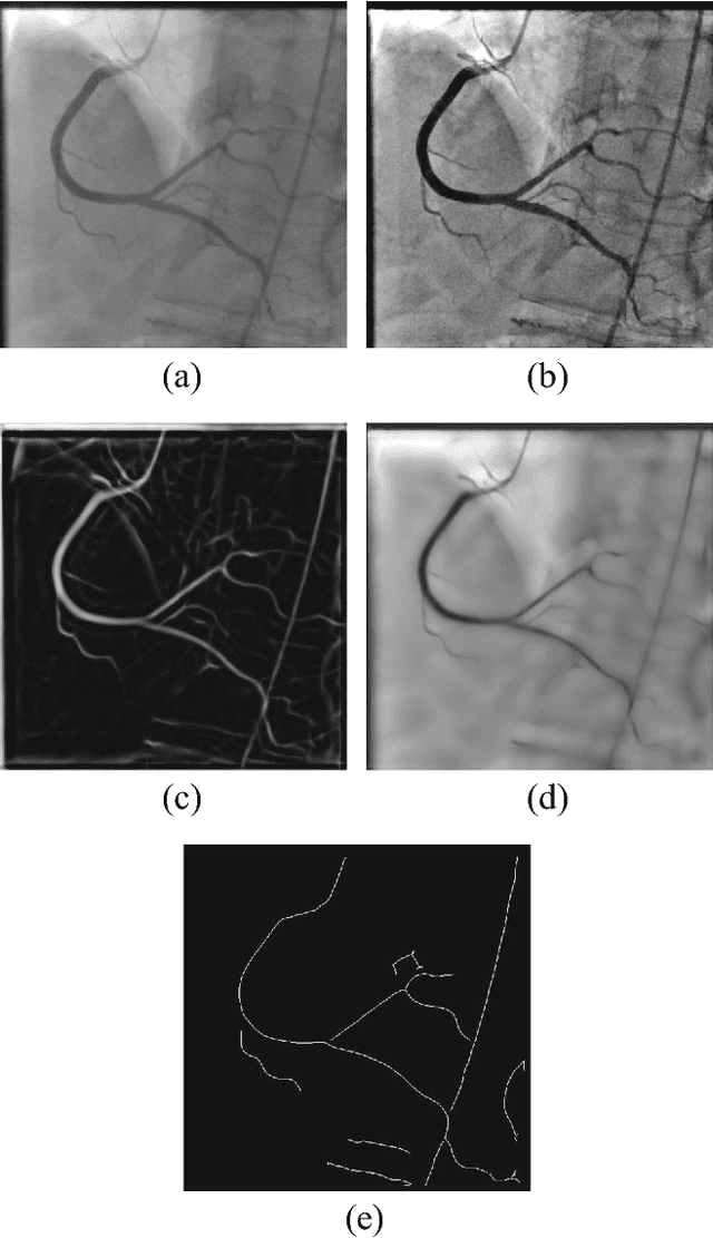 Figure 3 for Vessel Segmentation and Catheter Detection in X-Ray Angiograms Using Superpixels