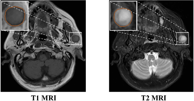 Figure 1 for Mutual Attention-based Hybrid Dimensional Network for Multimodal Imaging Computer-aided Diagnosis