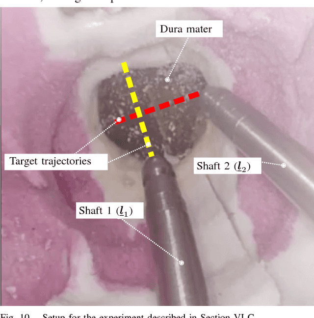 Figure 2 for Dynamic Active Constraints for Surgical Robots using Vector Field Inequalities