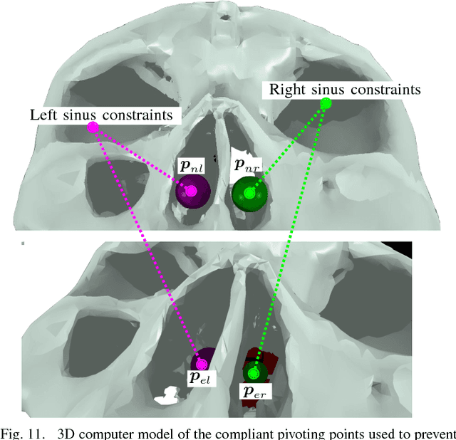 Figure 3 for Dynamic Active Constraints for Surgical Robots using Vector Field Inequalities