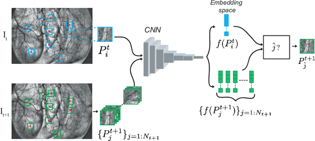 Figure 1 for Self-Supervised Endoscopic Image Key-Points Matching