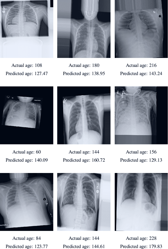 Figure 3 for Ridge Regression Neural Network for Pediatric Bone Age Assessment