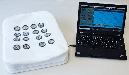 Figure 1 for Crackle Detection In Lung Sounds Using Transfer Learning And Multi-Input Convolitional Neural Networks