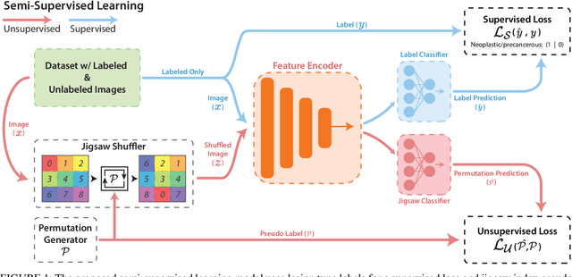 Figure 1 for Improving colonoscopy lesion classification using semi-supervised deep learning