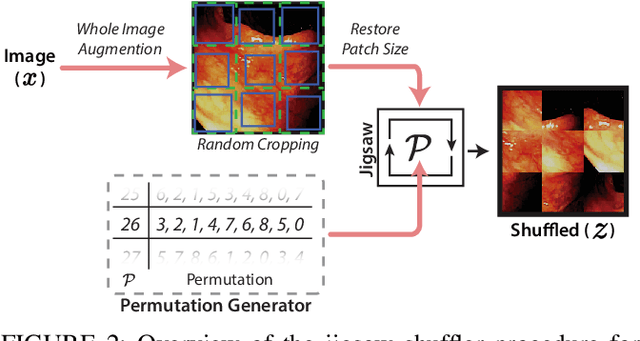 Figure 3 for Improving colonoscopy lesion classification using semi-supervised deep learning