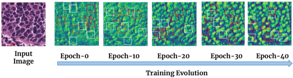 Figure 1 for Efficient Self-Supervision using Patch-based Contrastive Learning for Histopathology Image Segmentation