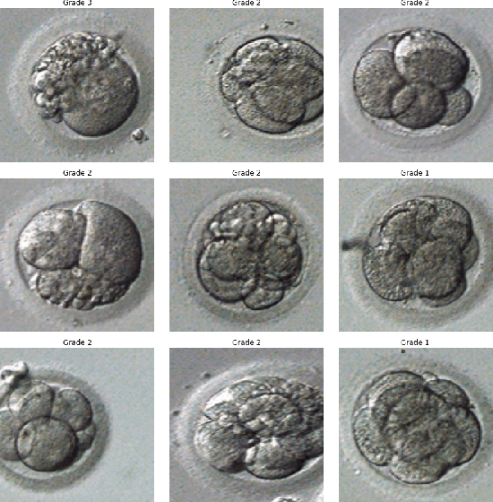 Figure 1 for Human Blastocyst Classification after In Vitro Fertilization Using Deep Learning