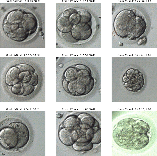 Figure 4 for Human Blastocyst Classification after In Vitro Fertilization Using Deep Learning