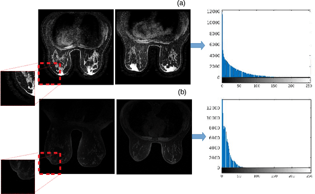 Figure 1 for Normalization of breast MRIs using Cycle-Consistent Generative Adversarial Networks