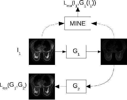 Figure 3 for Normalization of breast MRIs using Cycle-Consistent Generative Adversarial Networks