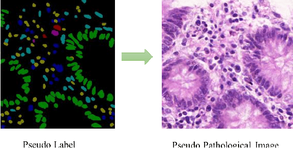 Figure 3 for Nuclear Segmentation and Classification Model with Imbalanced Classes for CoNiC Challenge