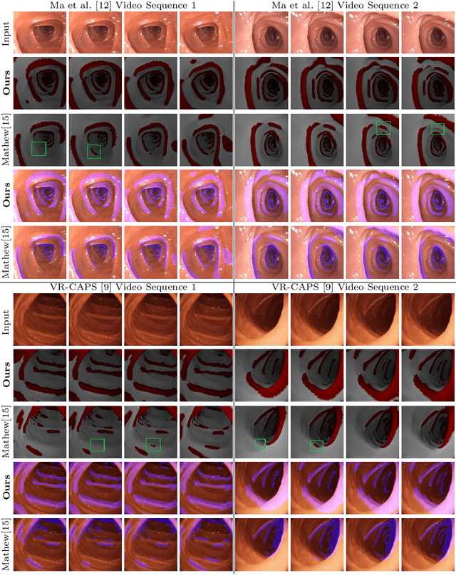 Figure 3 for FoldIt: Haustral Folds Detection and Segmentation in Colonoscopy Videos