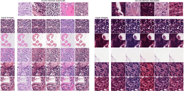 Figure 3 for Test-time image-to-image translation ensembling improves out-of-distribution generalization in histopathology