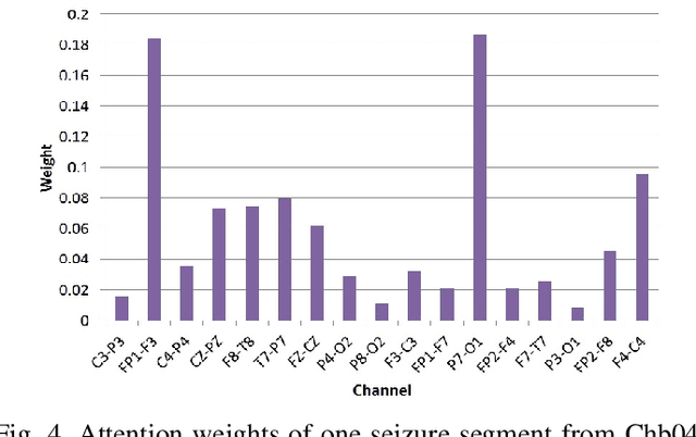 Figure 4 for Automated Classification of Seizures against Nonseizures: A Deep Learning Approach