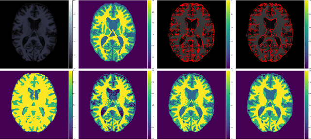 Figure 3 for A cross-center smoothness prior for variational Bayesian brain tissue segmentation