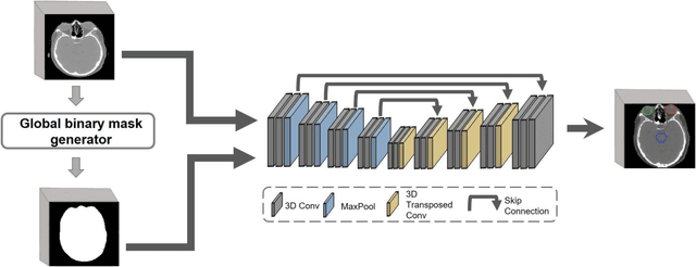 Figure 3 for Leveraging Global Binary Masks for Structure Segmentation in Medical Images