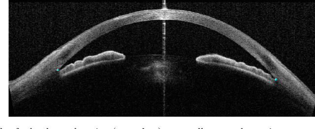 Figure 1 for Deep Learning Algorithms to Isolate and Quantify the Structures of the Anterior Segment in Optical Coherence Tomography Images