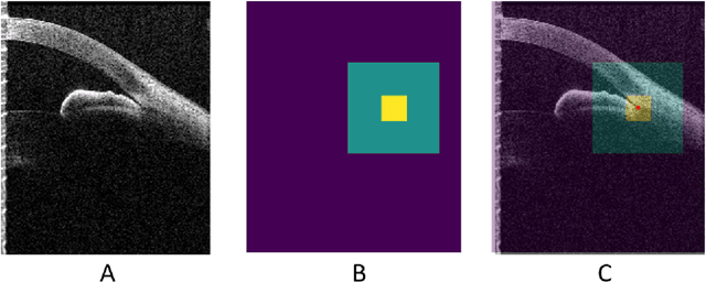 Figure 3 for Deep Learning Algorithms to Isolate and Quantify the Structures of the Anterior Segment in Optical Coherence Tomography Images
