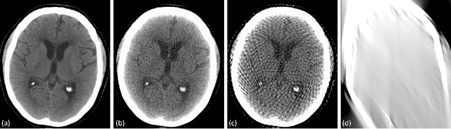 Figure 1 for Assessing Robustness to Noise: Low-Cost Head CT Triage