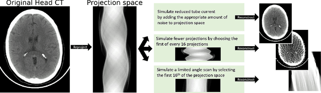 Figure 2 for Assessing Robustness to Noise: Low-Cost Head CT Triage