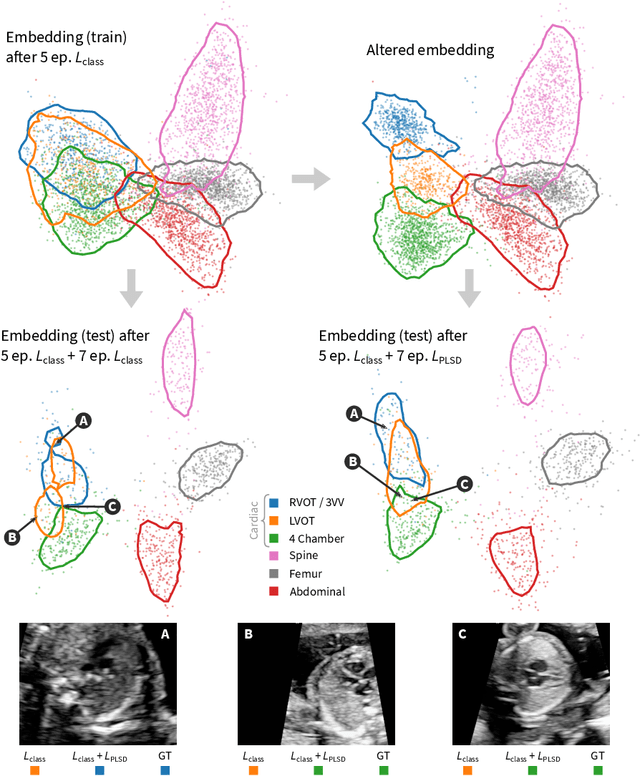 Figure 3 for Projective Latent Space Decluttering