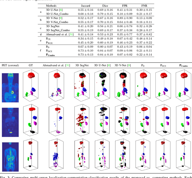 Figure 3 for Combo Loss: Handling Input and Output Imbalance in Multi-Organ Segmentation