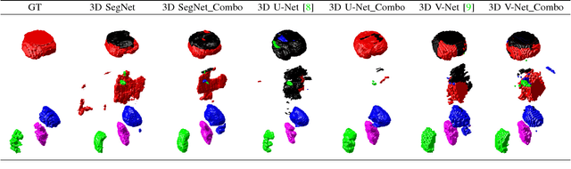 Figure 4 for Combo Loss: Handling Input and Output Imbalance in Multi-Organ Segmentation
