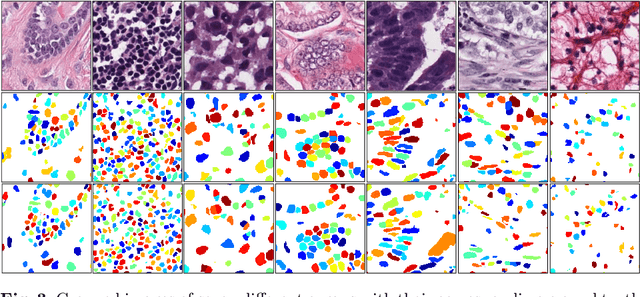 Figure 4 for Nuclear Instance Segmentation using a Proposal-Free Spatially Aware Deep Learning Framework