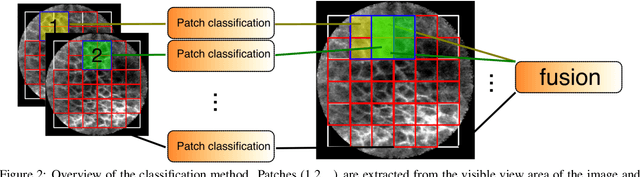 Figure 3 for Patch-based Carcinoma Detection on Confocal Laser Endomicroscopy Images - A Cross-Site Robustness Assessment