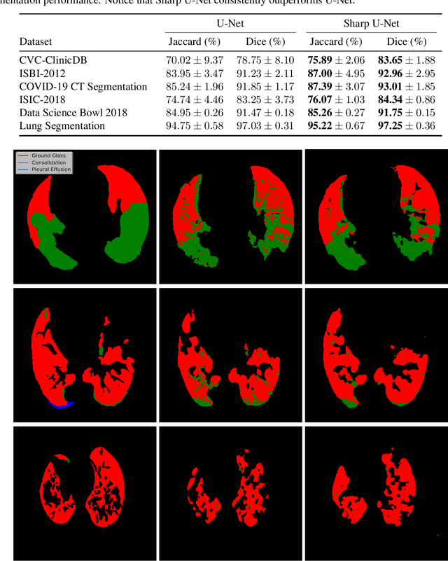 Figure 2 for Sharp U-Net: Depthwise Convolutional Network for Biomedical Image Segmentation