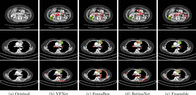 Figure 1 for Universal Lesion Detection in CT Scans using Neural Network Ensembles