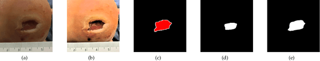 Figure 1 for Wound Segmentation with Dynamic Illumination Correction and Dual-view Semantic Fusion