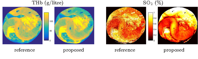 Figure 1 for Fast Estimation of Haemoglobin Concentration in Tissue Via Wavelet Decomposition