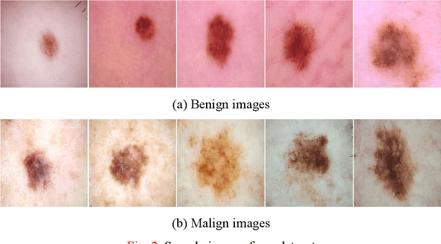 Figure 4 for New pyramidal hybrid textural and deep features based automatic skin cancer classification model: Ensemble DarkNet and textural feature extractor