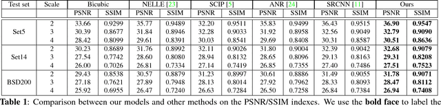 Figure 2 for Local- and Holistic- Structure Preserving Image Super Resolution via Deep Joint Component Learning